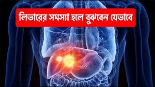 How to Identify Liver Problems | লিভারের সমস্যা হলে বুঝবেন যেভাবে