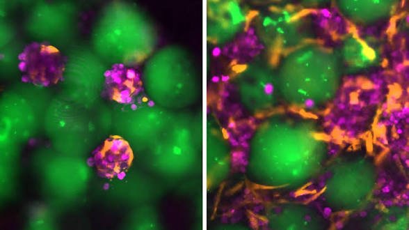 MIT team develops injectable ‘Mini Livers’ to support liver function