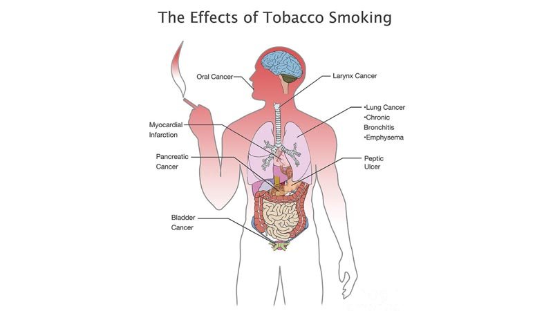 Call to implement graphic health warnings on all tobacco products
