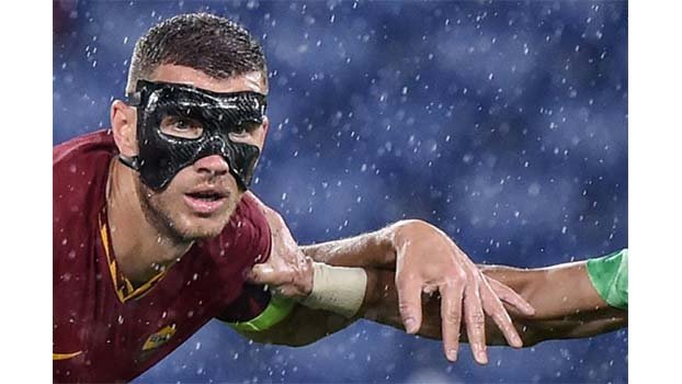 Dzeko ‘can’t see well’ but still scores