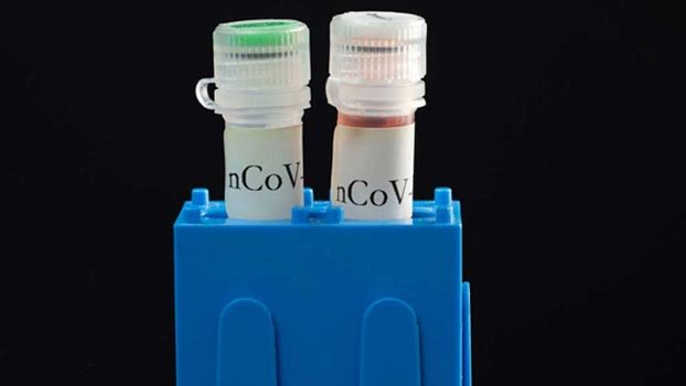 COVID-19 test goes on in Khulna