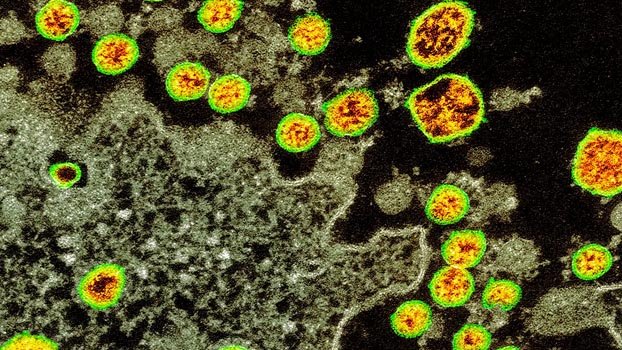 Global death toll rises to 154,188