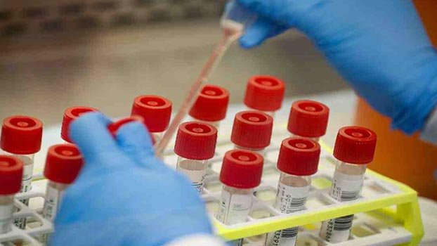 BLRI starts coronavirus testing