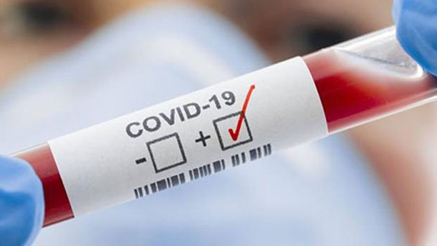 159 people affected with corona in Ctg