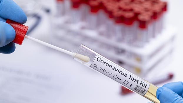 Corona test facilities still  too inadequate