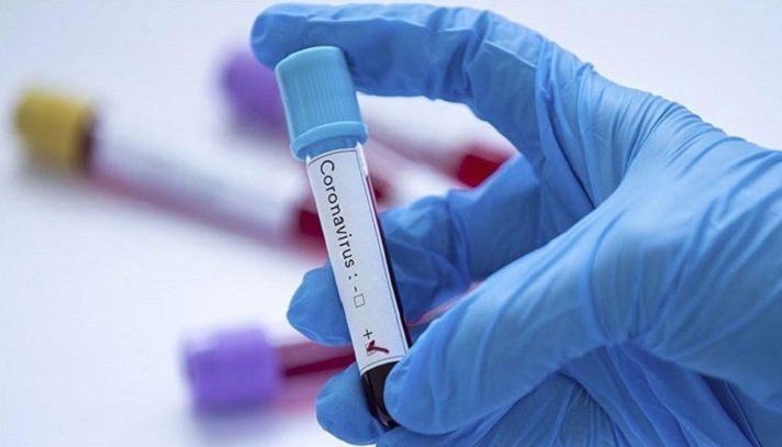 109 freshly infected by Covid-19 in Bogura