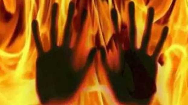 Husband sets his wife on fire in Madhya Pradesh