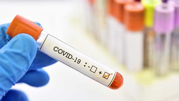 2,053 Covid-19 patients detected in Jhenaidah, 35 die so far