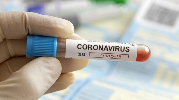 20 more test positive for Covid in C’nawabganj