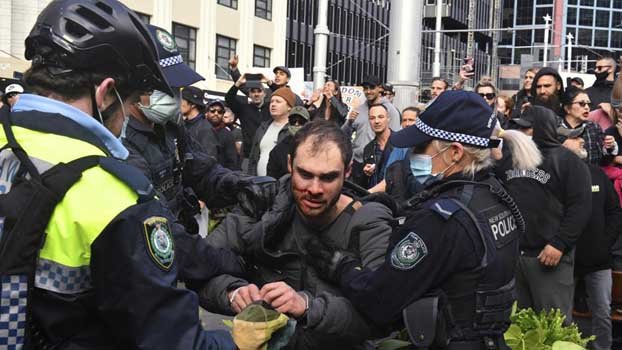 Thousands protest lockdown in Sydney, several arrested