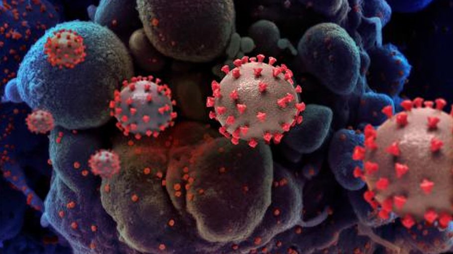 2 Covid deaths   in 24 hours