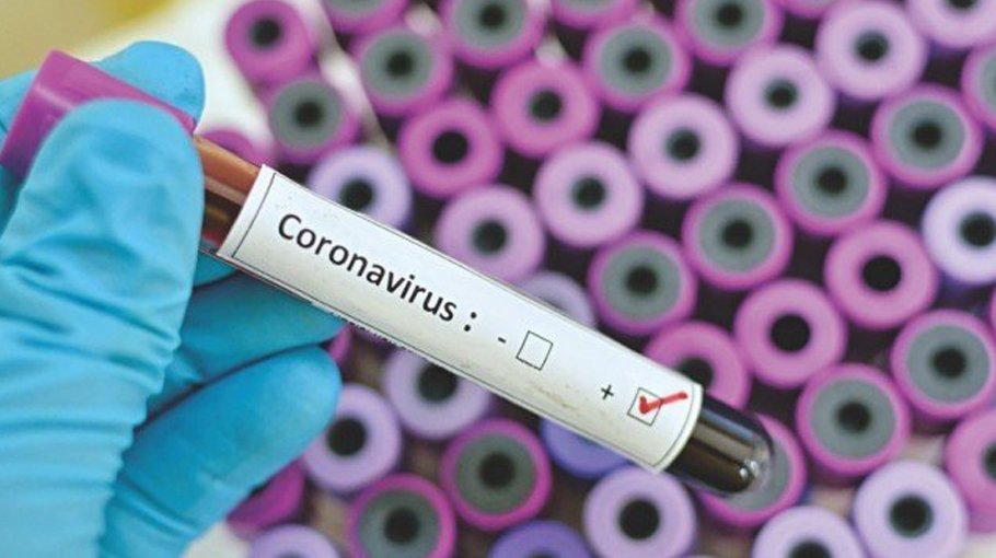 29 test positive for Covid-19 in Ctg