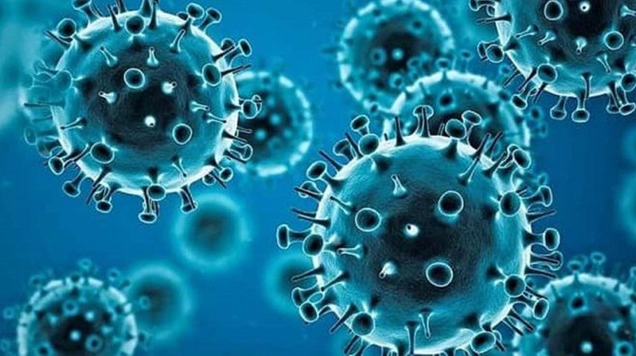 29 new Covid cases reported in country