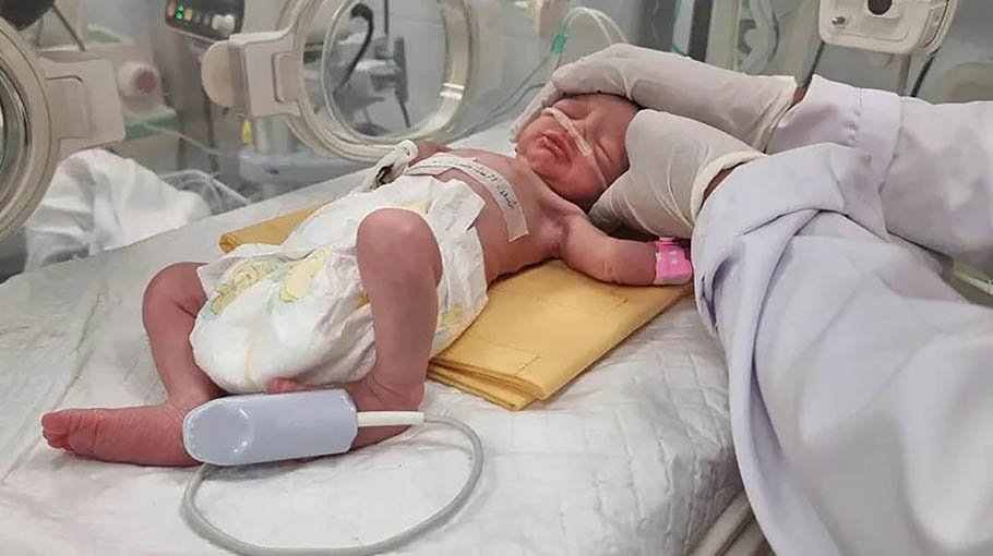 Premature baby rescued from dead mother’s womb dies in Gaza