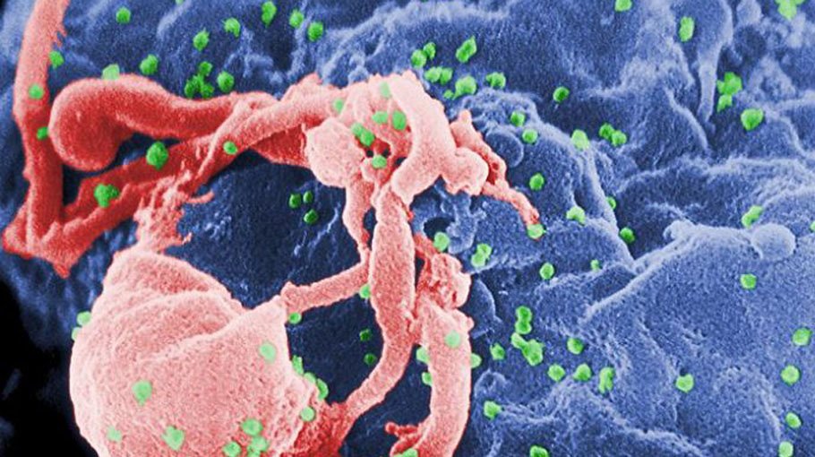 Bangladesh to eradicate HIV by 2030