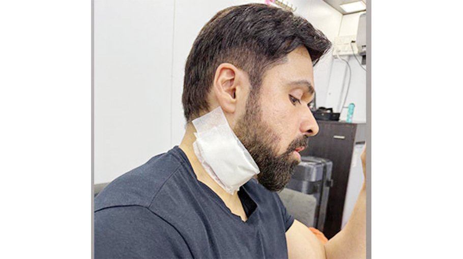 Emraan Hashmi suffers neck injury 