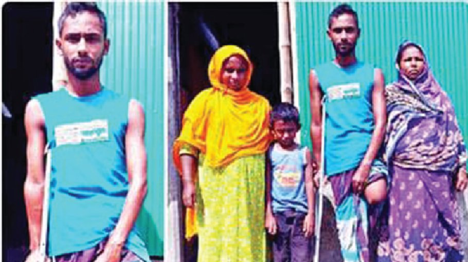 July Mass Upsurge Momdel lost leg as he sustained bullet injuries