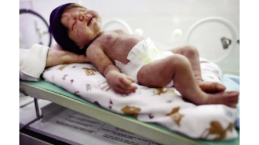 Brazil’s lifelike doll craze goes from shopping malls to state legislatures