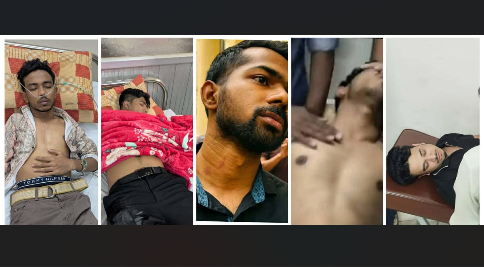 11 jurnos among 12 injured in attack led by JnU Shibir