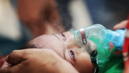 Measles death toll reaches 766 as 7 more children die in 24 hours